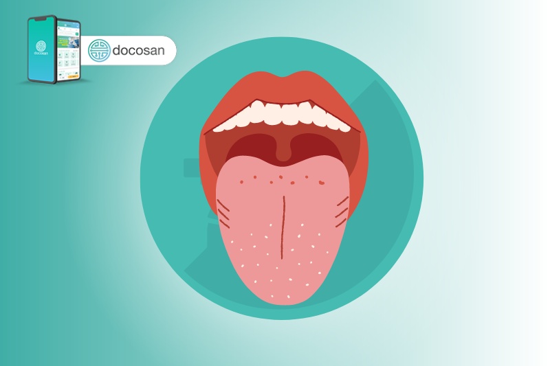 Lưỡi nổi mụn thịt là vấn đề không chỉ gây ra sự khó chịu về mặt thẩm mỹ mà còn gây ra cảm giác đau rát khó chịu. Hãy xem hình ảnh liên quan đến từ khóa này để hiểu rõ hơn về nguyên nhân và các phương pháp điều trị để cải thiện tình trạng sức khỏe của mình.