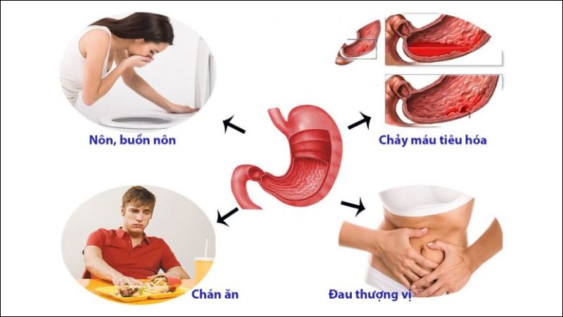 Các dấu hiệu, triệu chứng nhận biết đau bao tử