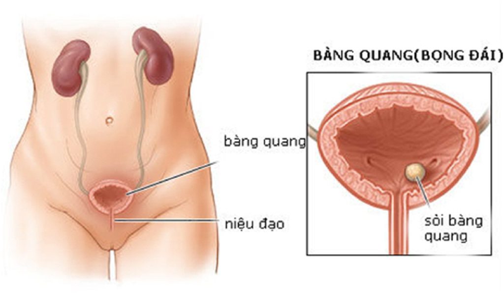 soi-bang-quang