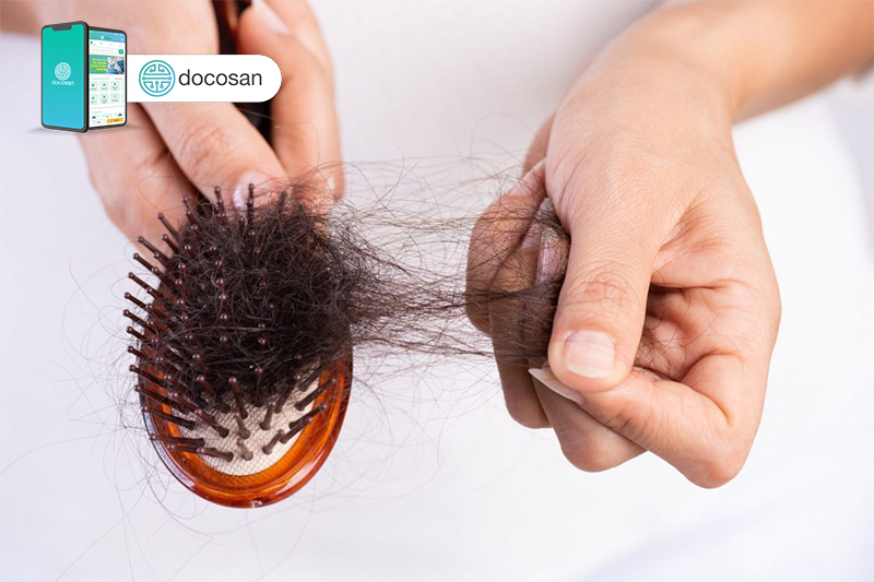 Tóc rụng nhiều là bệnh gì Cách khắc phục tình trạng này như thế nào   Medlatec