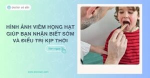 Hình ảnh viêm họng hạt giúp bạn nhận biết sớm và điều trị kịp thời