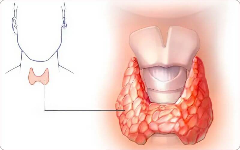 Tuyến giáp nằm ở phía trước cổ, hình dạng như cánh bướm