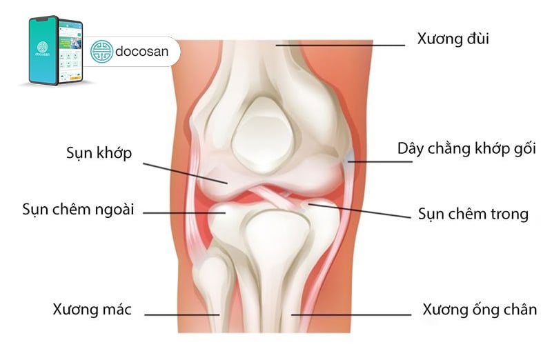 đau khớp gối