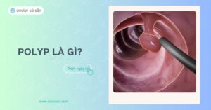 Polyp là gì? 10 bệnh Polyp - Nguyên nhân, triệu chứng nhận biết