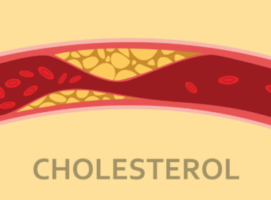 cholesterol-cao