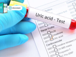 acid uric trong máu cao