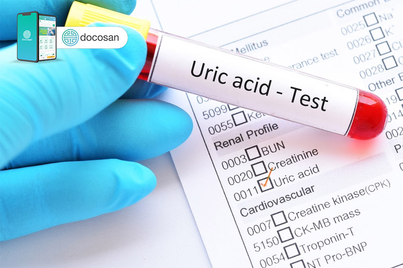 acid uric trong máu cao