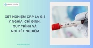 Xét nghiệm CRP là gì? Ý nghĩa, chỉ định, quy trình và nơi xét nghiệm