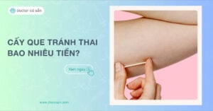 Cấy que tránh thai bao nhiêu tiền Thông tin giá và lưu ý khi cấy