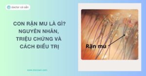 Con rận (rận mu) là gì? Nguyên nhân, triệu chứng, cách điều trị