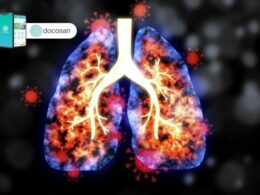 Ung thư phổi di căn