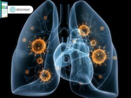 Ung thư phổi có di truyền hay không