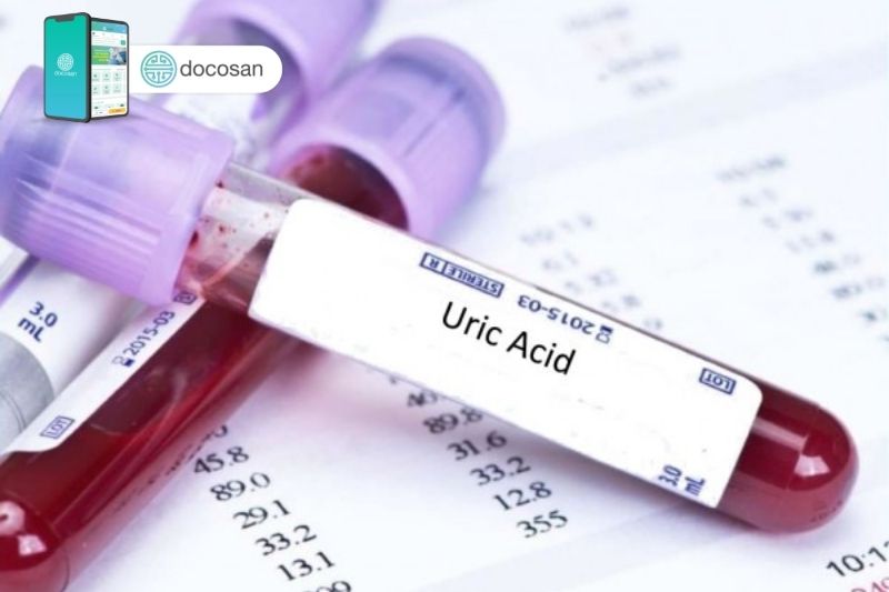 chỉ số acid uric bình thường