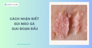 Sùi mào gà giai đoạn đầu ở nam, nữ có chữa khỏi không? Các nhận biết