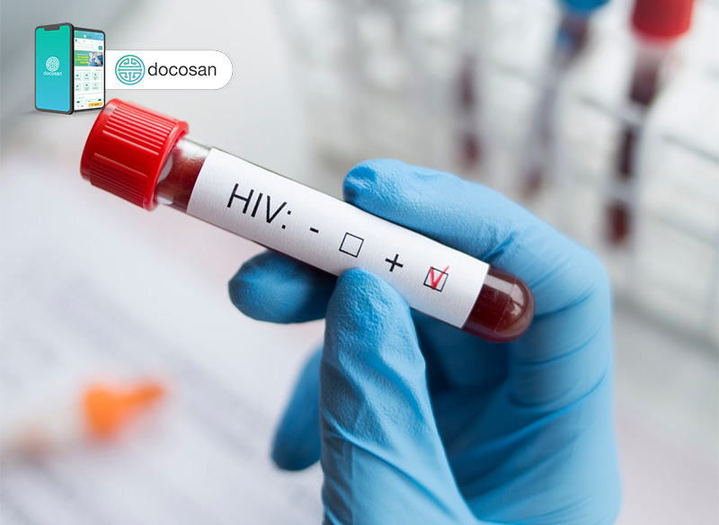 chi phí xét nghiệm hiv