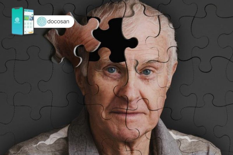 triệu chứng Alzheimer