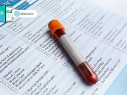 bảng giá xét nghiệm máu