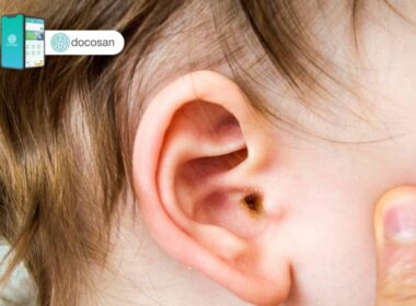 dấu hiệu viêm tai giữa