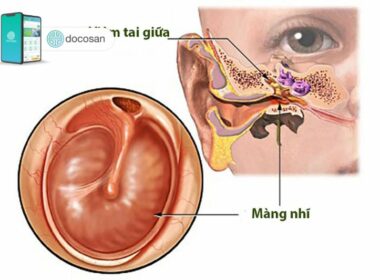 triệu chứng viêm tai giữa