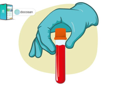 xét nghiệm máu chẩn đoán rối loạn cương dương