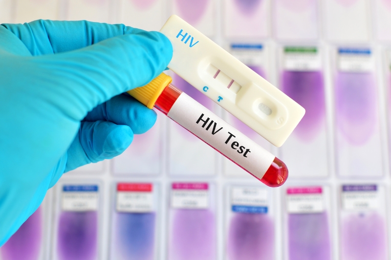 thời điểm xét nghiệm hiv