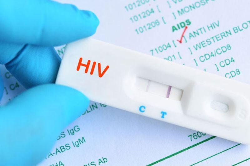 Kit xét nghiệm nhanh HIV 