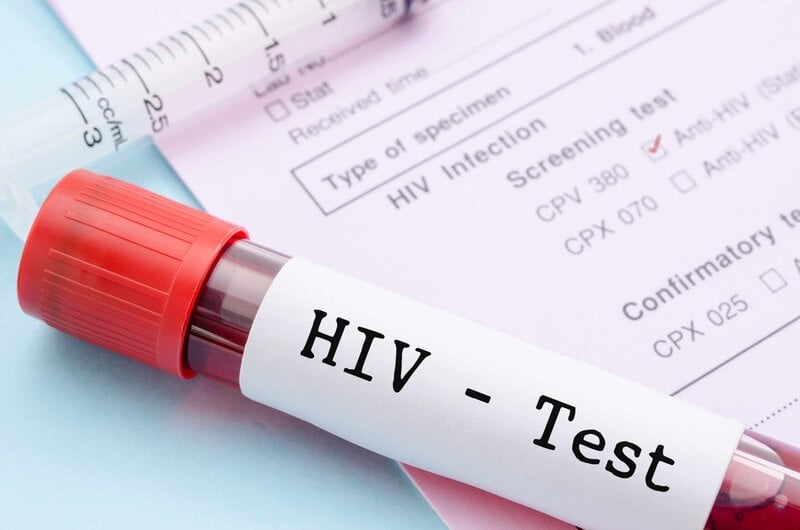 Hãy trao đổi với bạn tình về việc xét nghiệm HIV trước khi quan hệ tình dục