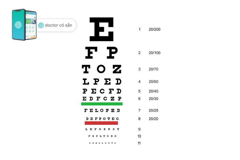 Cách tính độ cận thị của mắt Số hiển thị trên Diop tương đương với độ cận.