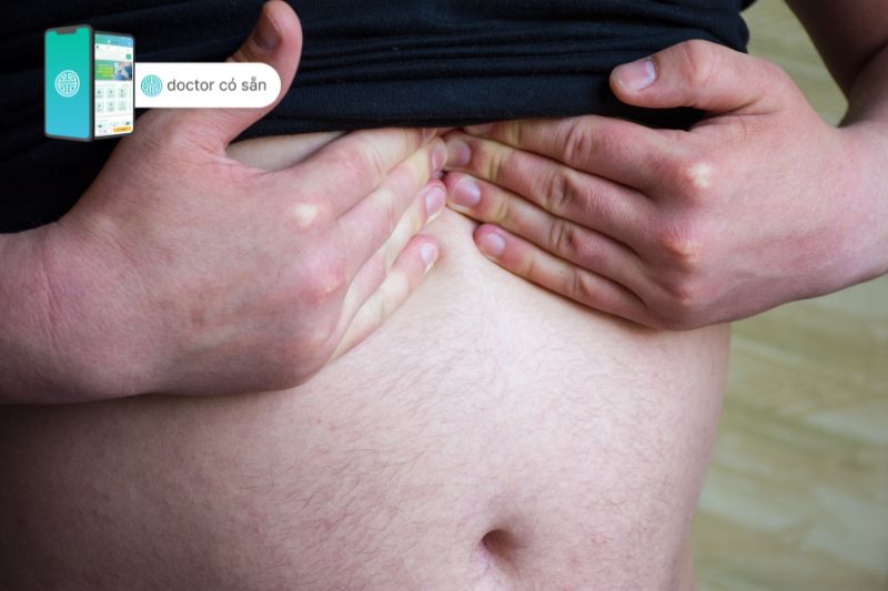 Người béo bụng có nguy cơ mắc bệnh Barrett thực quản