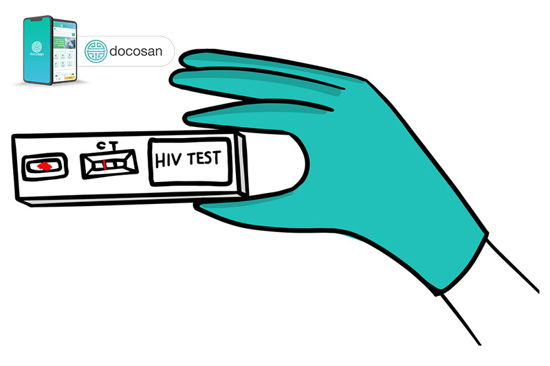 How much does an HIV test cost? Where is the reputation test? Doctor