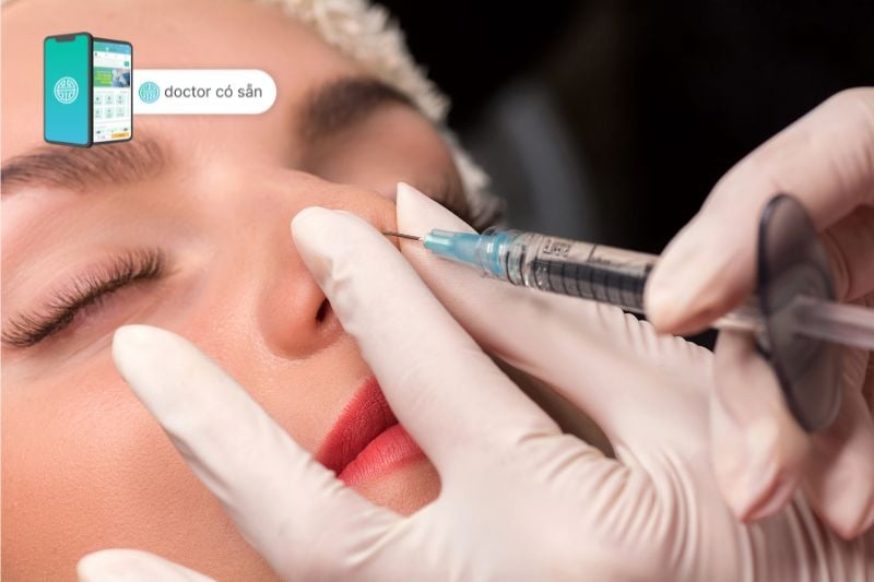 Tiêm filler mũi là một thủ thuật tạo hình không cần phẫu thuật