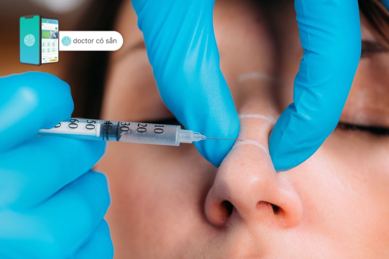 Thực hiện thủ thuật tiêm filler cho bệnh nhân