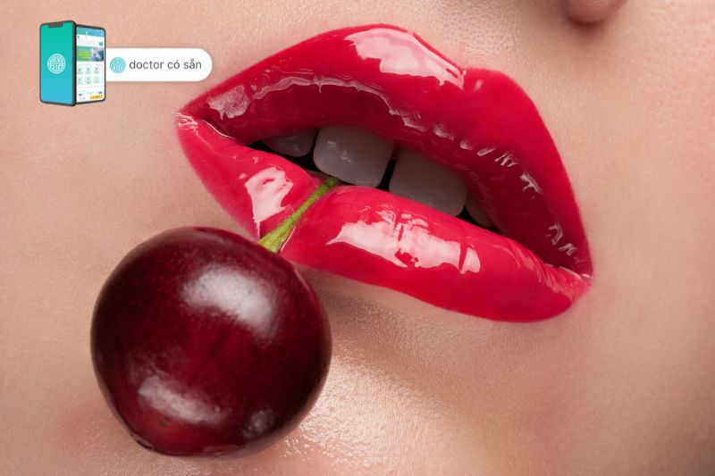 Tiêm filler môi dáng quả cherry