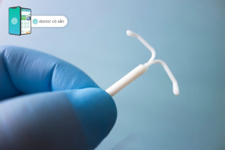 Copper IUD Your comprehensive guide Doctor có sẵn