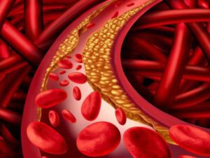 Tìm hiểu chi tiết về cholesterol là gì?