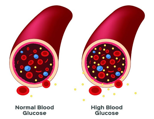 Mô phỏng định lượng glucose trong máu