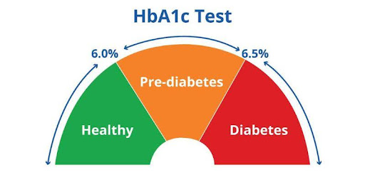 Các chỉ số xét nghiệm HbA1c cần lưu ý