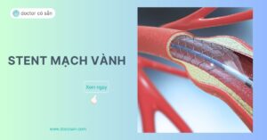 Đặt stent mạch vành là một thủ thuật cấp cứu tim mạch được sử dụng để tái lưu thông mạch vành cấp máu nuôi cơ tim.