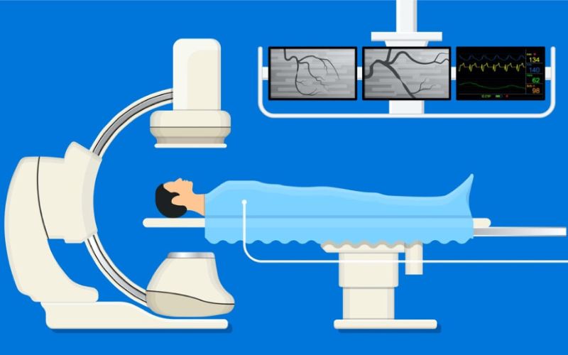 Quy trình đặt stent được chia thành trước, trong và sau can thiệp.