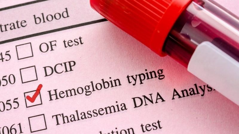 Xét nghiệm hemoglobin (xét nghiệm Hb) dùng để đo nồng độ hemoglobin trong máu