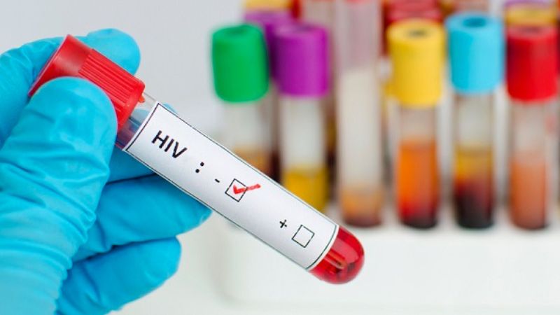 Hiện nay có 03 phương pháp xét nghiệm HIV chủ yếu