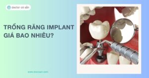 Trồng răng implant giá bao nhiêu