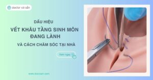 4 dấu hiệu vết khâu tầng sinh môn đang lành và cách chăm sóc tại nhà