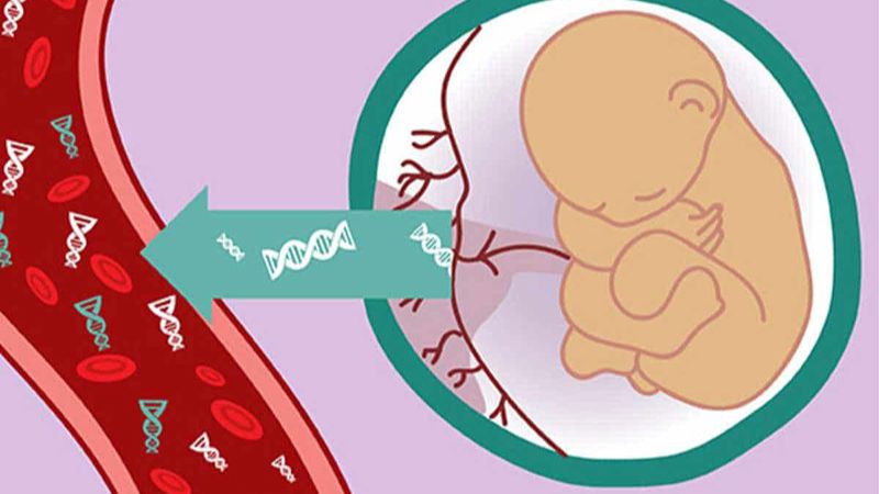 NIPT được thực hiện bằng cách lấy mẫu máu có chứa các đoạn DNA của thai nhi từ người mẹ