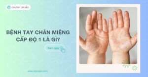 Bệnh tay chân miệng cấp độ 1 là gì? Nguyên nhân, dấu hiệu và điều trị