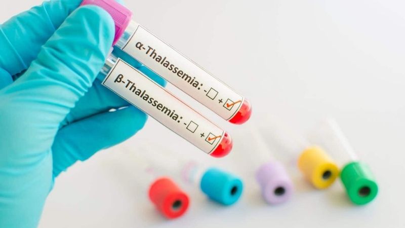 Có thể chủ động tầm soát gen bệnh thalassemia ngay từ khi còn trong bào thai