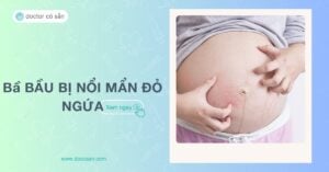 Bà bầu bị nổi mẩn đỏ ngứa: Nguyên nhân và cách khắc phục