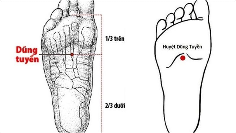 Kích thích huyệt Dũng tuyền có tác dụng giảm đau, giảm sưng và tê bì bàn chân