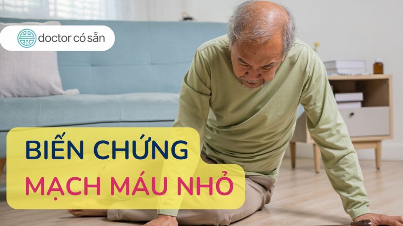 Bệnh đái tháo đường nếu không được kiểm soát tốt có thể gây ra nhiều biến chứng nguy hiểm, đặc biệt là các biến chứng mạch máu nhỏ