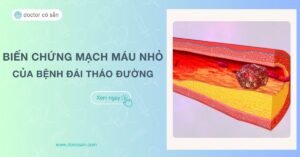 Biến chứng mạch máu nhỏ của bệnh đái tháo đường